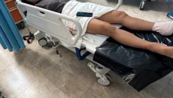 Россиянка в отеле на Занзибаре провалилась в колодец и сломала ноги